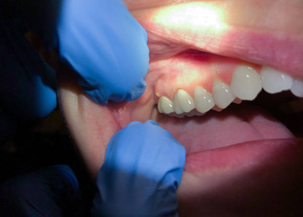 Best Emergency Gum Pain Relief  in Belmont, VA
