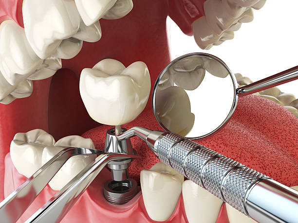 Best Tooth Pain Emergency Relief  in Belmont, VA